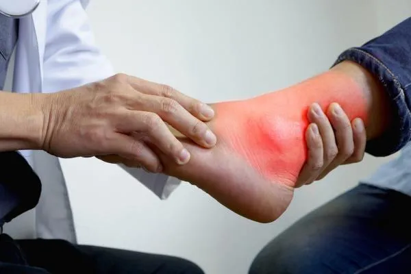 Bệnh gout là gì? Chia sẻ chế độ ăn cho người bị gout