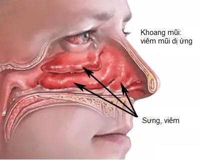 Lợi ích của việc uống nước nóng mùa thu đông