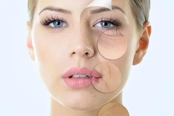 Tìm hiểu viên uống trắng da collagen có hiệu quả?